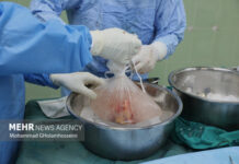 دختر ۲۰ ساله کنگانی به ۳ بیمار نیازمند به عضو حیاتی دوباره بخشید