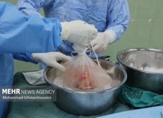 دختر ۲۰ ساله کنگانی به ۳ بیمار نیازمند به عضو حیاتی دوباره بخشید